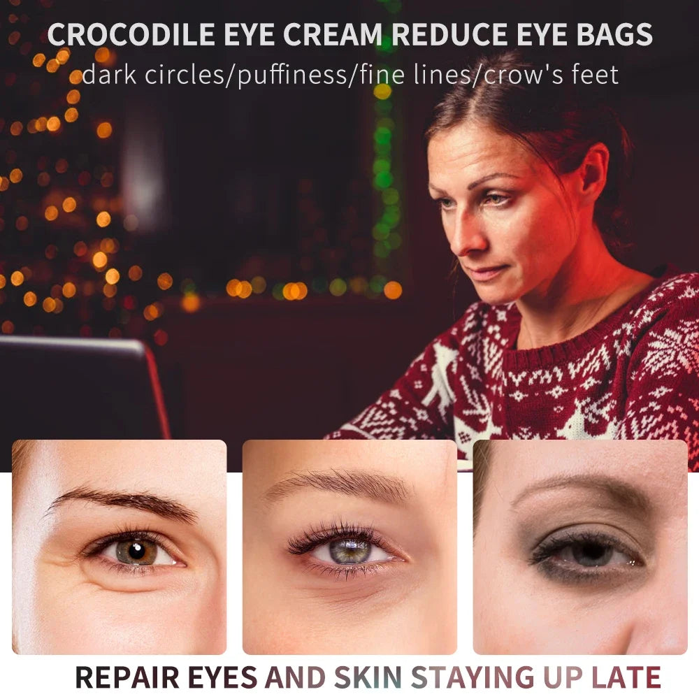 20g Peptide Collagen Anti Wrinkle Eye Cream Lightens Dark Circles and Removes Eye Bags Anti Aging Hydrating Eye Care Essence