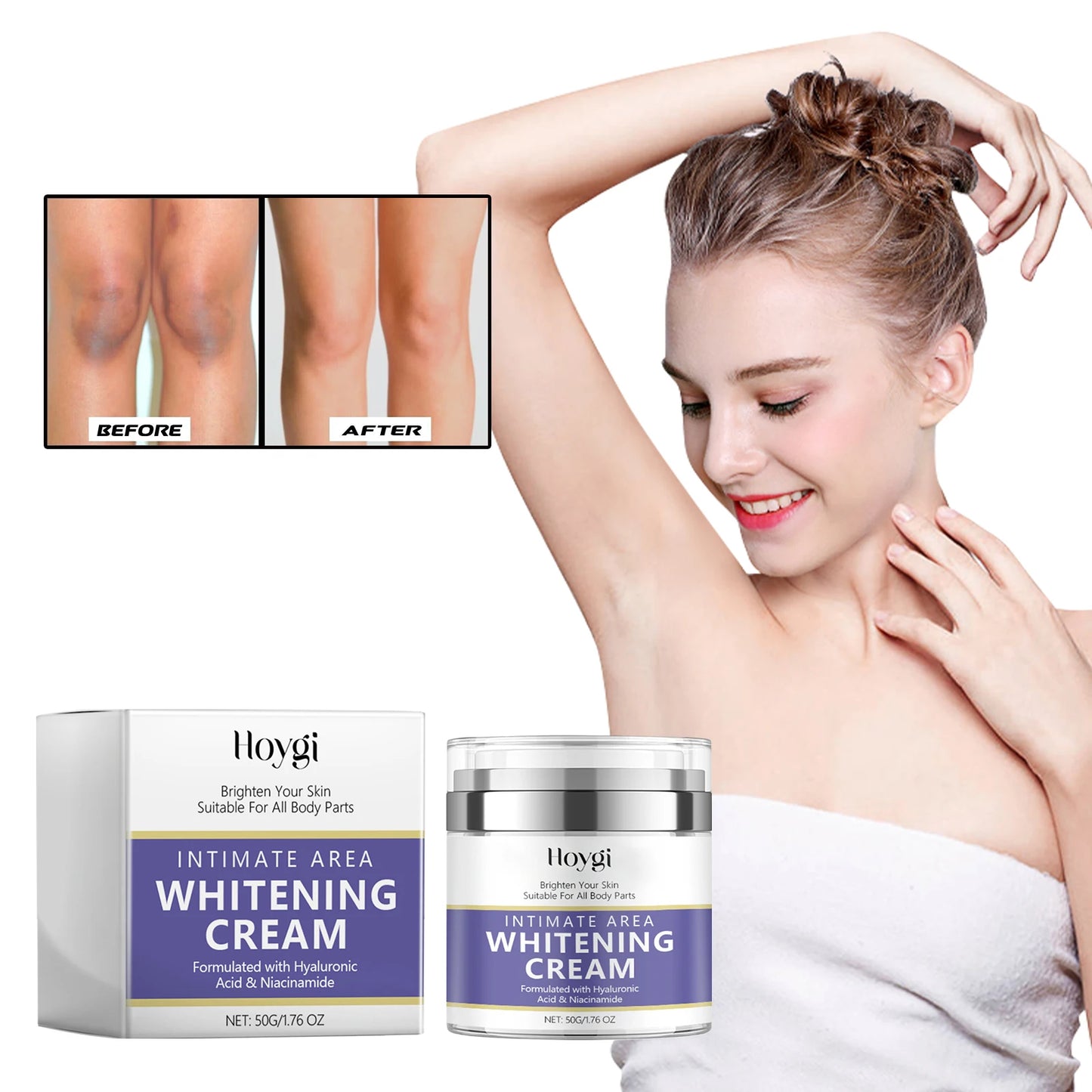 50g Hoygi Black Spot Whitening Correction Cream Reduce Fine Lines Anti-Aging Remove Body Black Spots Whiten Facial Beauty Cream